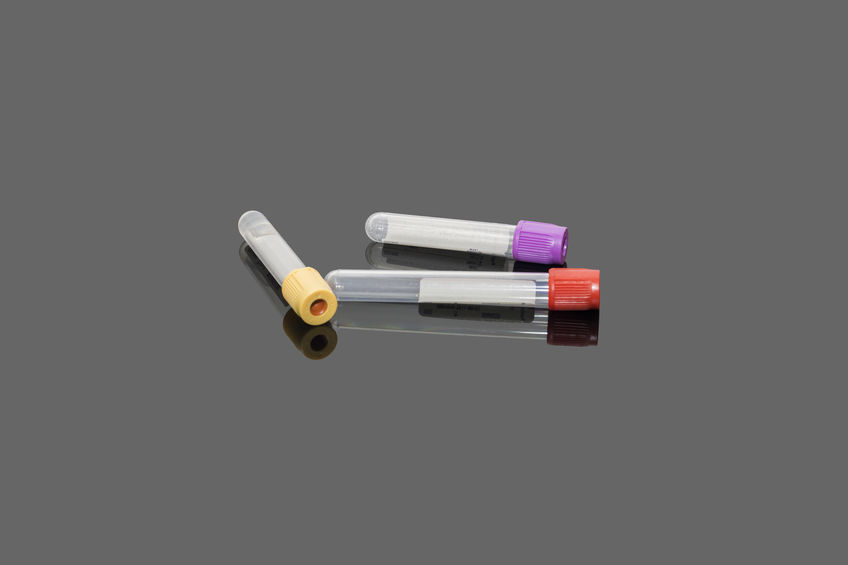 Criminal Defense Attorney For Blood and Alcohol Tests, Blood Test